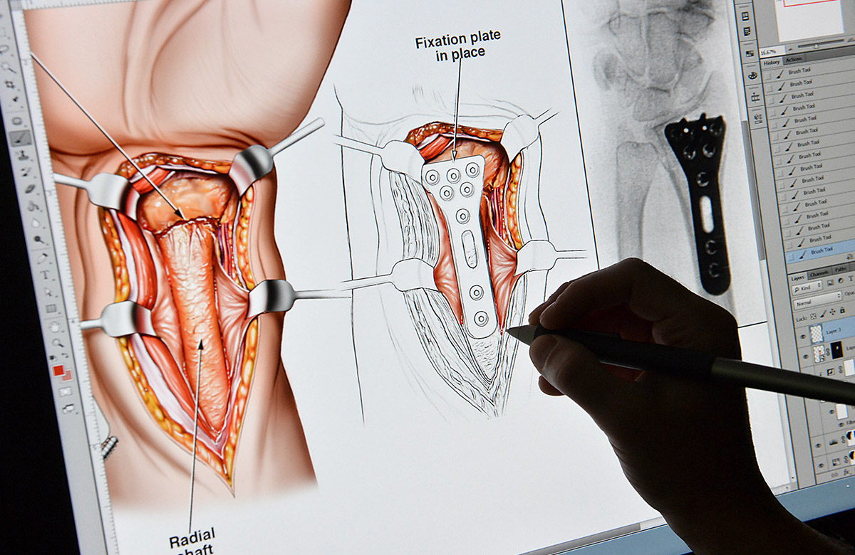 Medical Illustrations