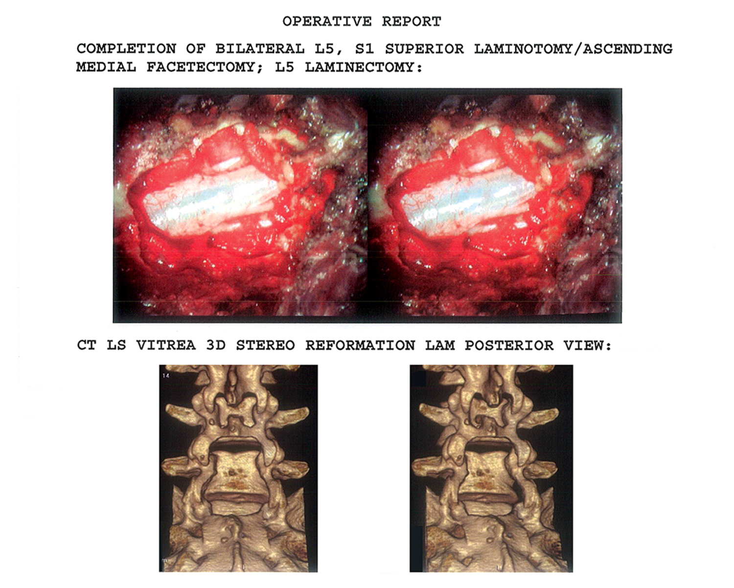 Trial Exhibits For Op Reports