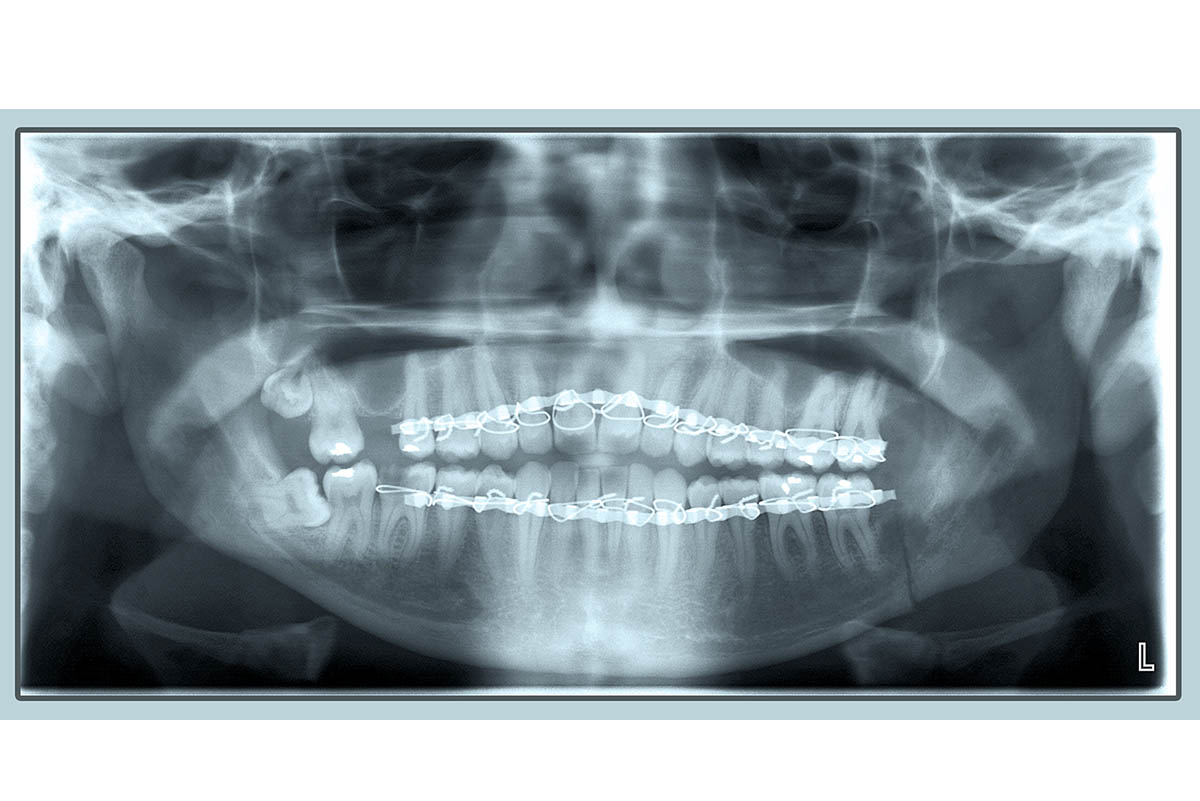 dental.jpg