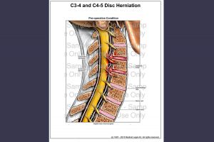 Doe Report 2