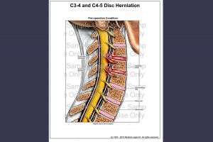 Doe Report 2